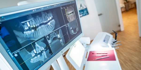 digitales Röntgen mit wenig Strahlenbelastung bei Zahnarzt Zittel in Riegel am Kaiserstuhl bei Emmendingen nahe Freiburg